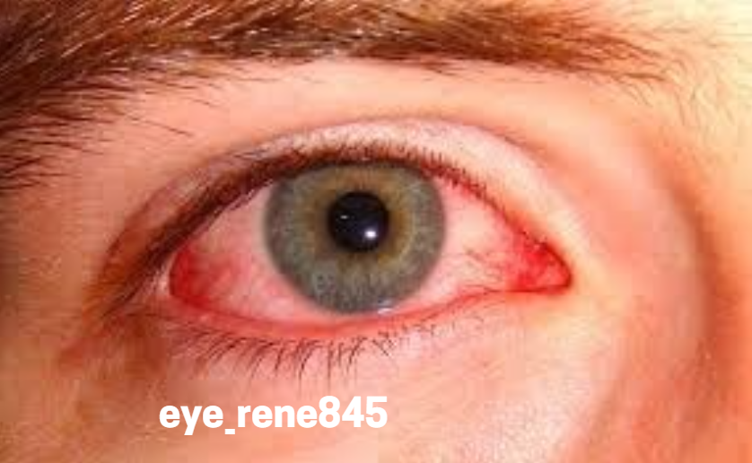 eye_rene845