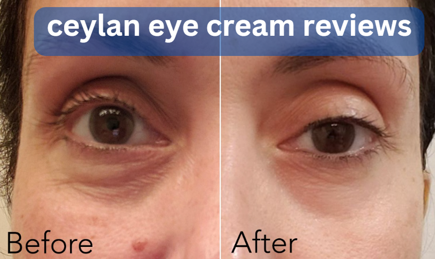 ceylan eye cream reviews